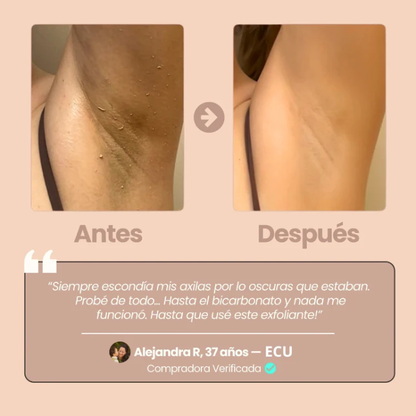 Quarxery Gel - Exfoliante Aclarador