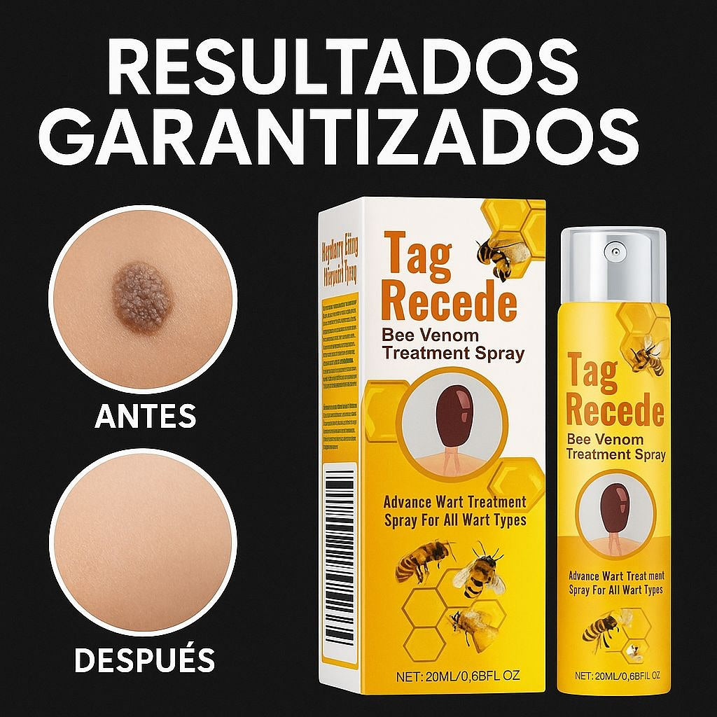 Tag Recede Eliminador de verrugas